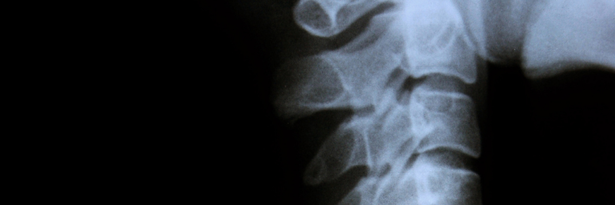 Back & Spine Surgery