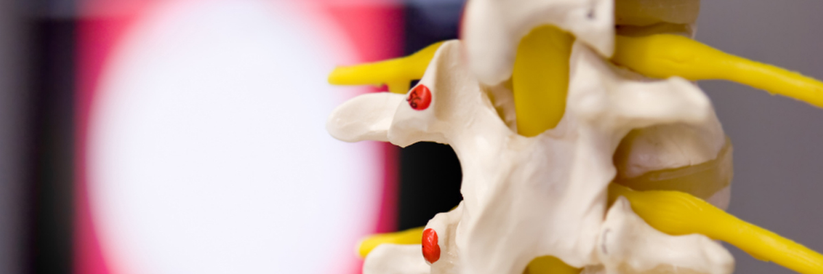 Back & Spine Surgery
