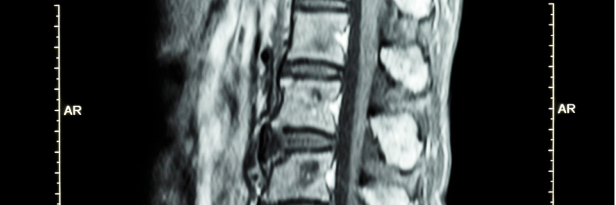 Back & Spine Surgery