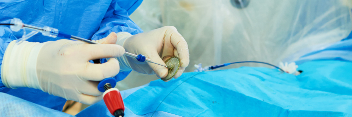General Surgery