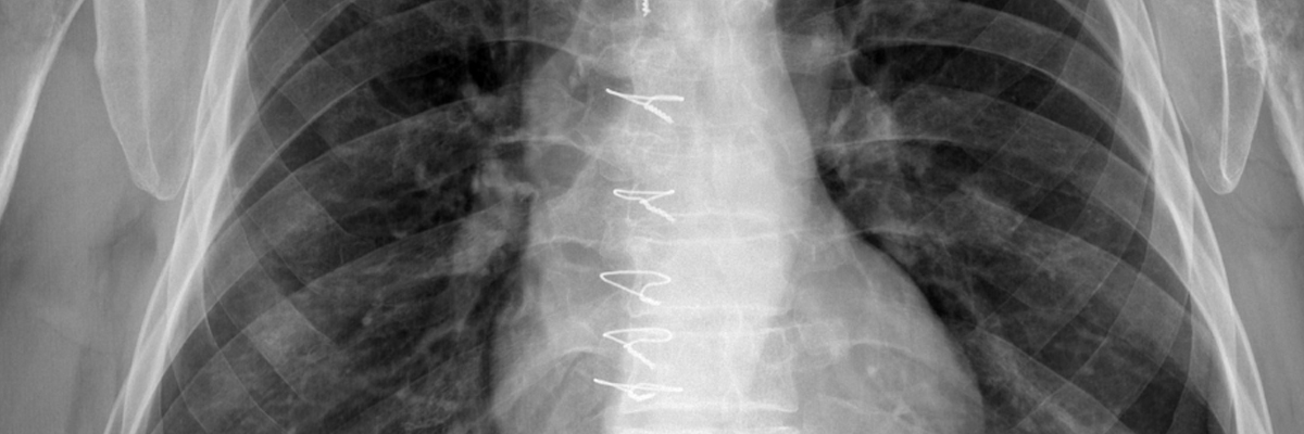 Pulmonology