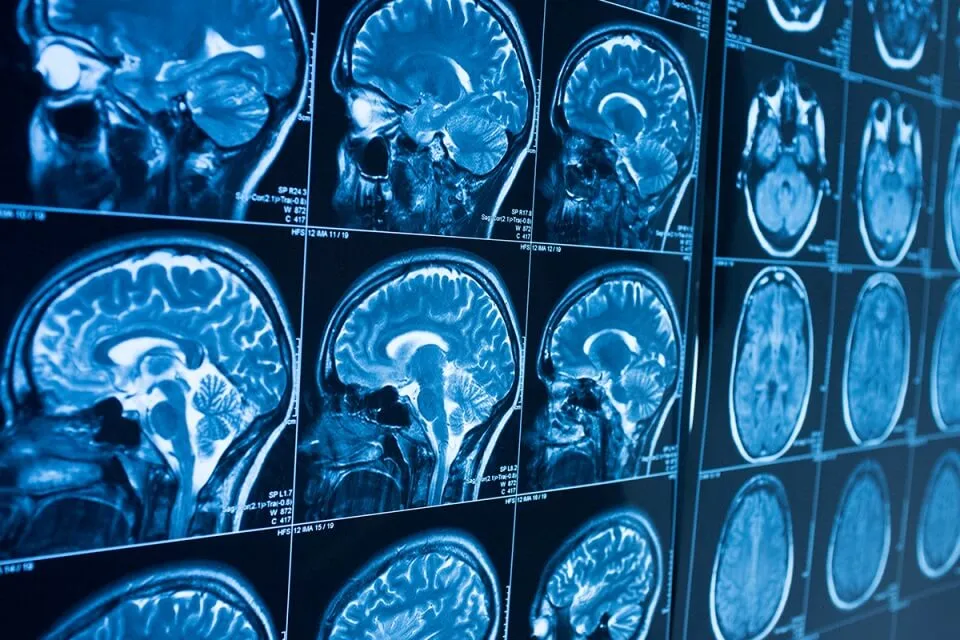 International Day of Radiology 2021