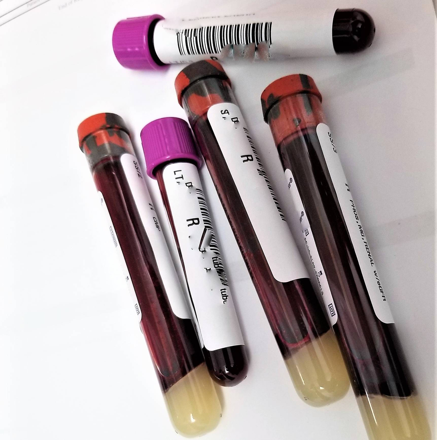 How Health Screenings Tests Keep The Body At Optimal Function