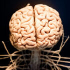 What Happens to Your Body During a Stroke?