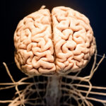 What Happens to Your Body During a Stroke?